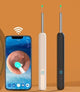 Smart Visual Ear Spoon Tool Set