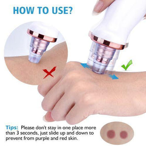 Pore Vacuum Blackhead Remover