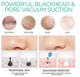 Pore Vacuum Blackhead Remover